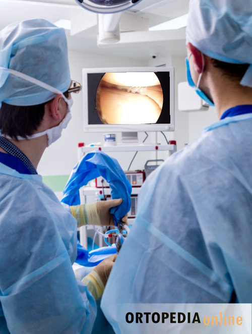 Operacja ortopedyczna - artroskopia